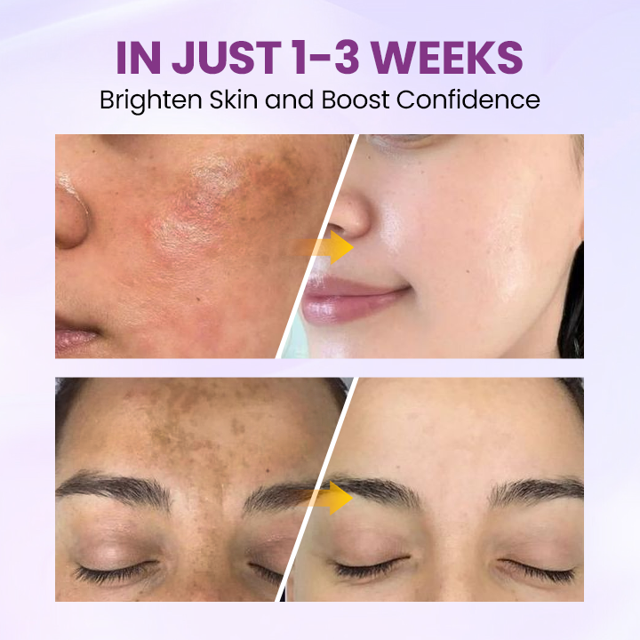 LOVILDS® RadiantClear Blemish & Brightening Serum