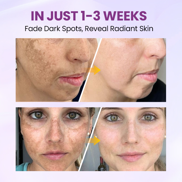 LOVILDS® RadiantClear Blemish & Brightening Serum