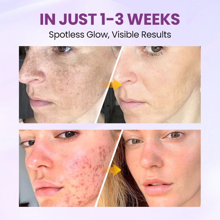 LOVILDS® RadiantClear Blemish & Brightening Serum