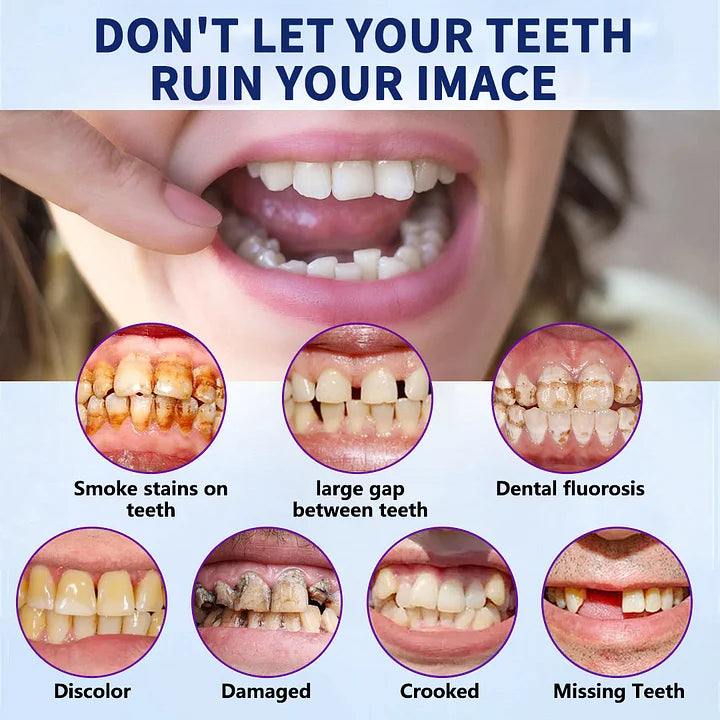 TAILEDEN™-New Generation Flexible Full Denture Solution
