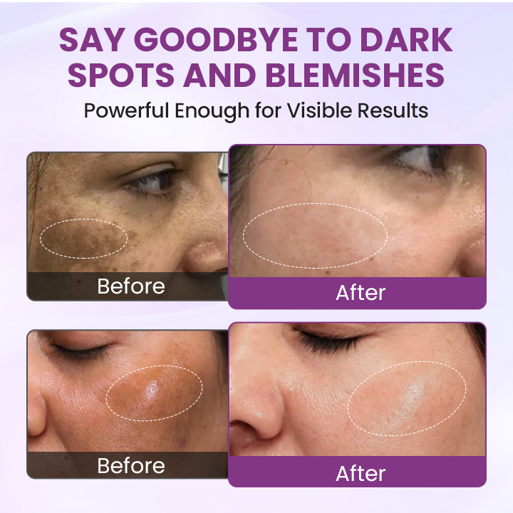 LOVILDS® RadiantClear Blemish & Brightening Serum