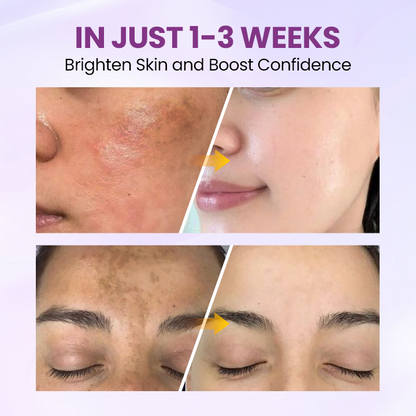 LOVILDS® RadiantClear Blemish & Brightening Serum