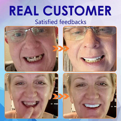 TAILEDEN™-New Generation Flexible Full Denture Solution