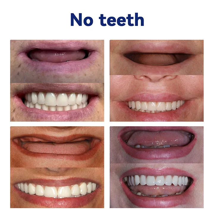TAILEDEN™-New Generation Flexible Full Denture Solution