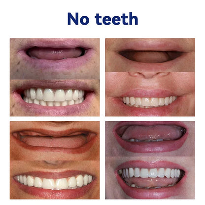 TAILEDEN™-New Generation Flexible Full Denture Solution